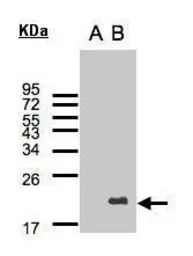 UBE2C antibody [N1C3]