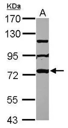 MPHOSPH10 antibody