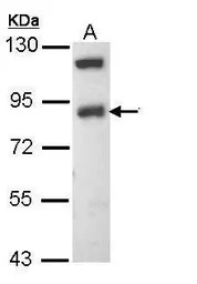ENaC Beta antibody [N2C1], Int