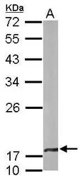 beta A4 Crystallin antibody [N
