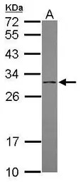 DCI antibody [N1C2]