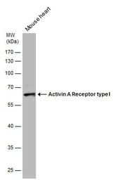 Activin Receptor Type IA antib