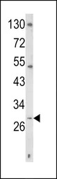 CD40L / CD154 antibody, C-term