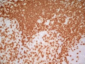 CD3 epsilon antibody [UCHT1] (