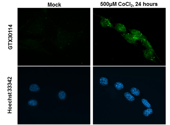HIF2 alpha antibody