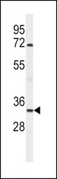 Apolipoprotein D antibody, N-t