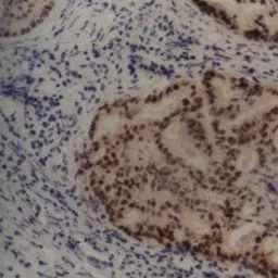 MDM2 antibody [SMP14]