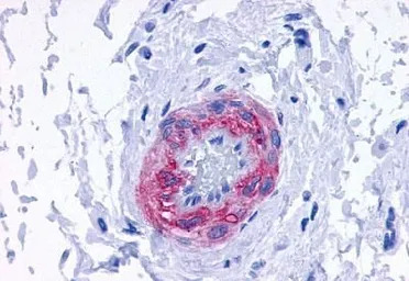 alpha 1d Adrenergic Receptor a