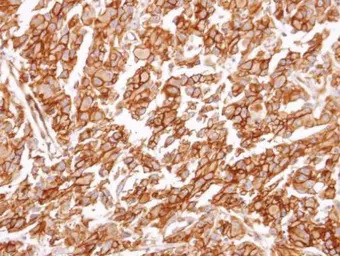 CysLT1 Receptor antibody [N1],