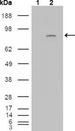 FGFR4 antibody [4H2B10B2]