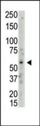 PRMT3 antibody