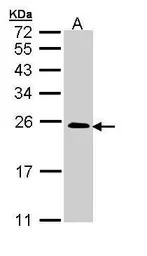 TC21 antibody [N1C3]