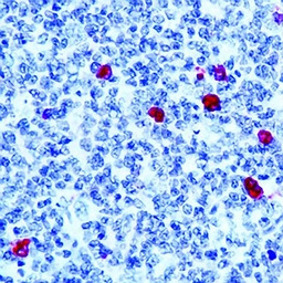 Rabbit Anti-Human IgM antibody