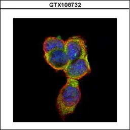 CD66e antibody