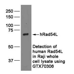 RAD54L antibody [60.1]