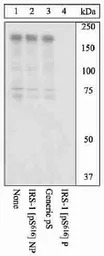 IRS1 (phospho Ser616) antibody