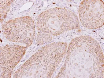 PECR antibody [C2C3], C-term