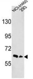 EphA3 antibody, N-term