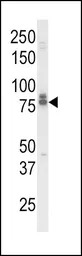IL18 Receptor beta antibody, N