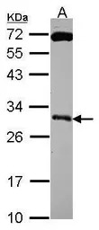 Kallikrein 10 antibody [N2C3]