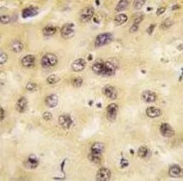 PROX1 antibody, Internal