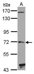 HHIP antibody [C1C3]