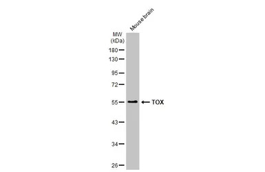 TOX antibody [N1C1]