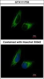 PFKFB1 antibody [N1N3]