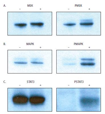 Halt 磷酸酶抑制剂混合物