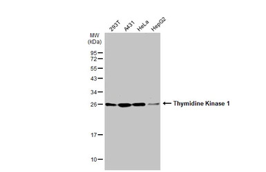 Thymidine Kinase 1 antibody