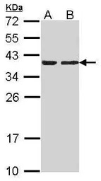 CAPZA2 antibody [N2C3]