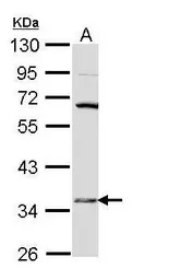 HSD17B6 antibody [N1C3]