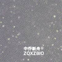 人心脏微血管内皮细胞-永生化