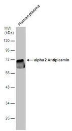 Alpha 2 Antiplasmin antibody [