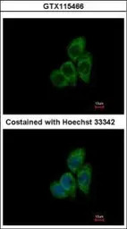 TCP1 theta antibody