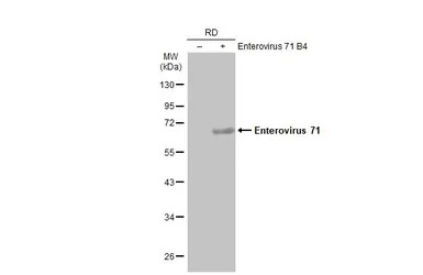 Enterovirus 71 antibody