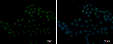 DDX21 antibody [N1N3]