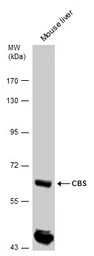 CBS antibody