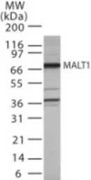 MALT1 antibody