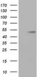 alpha Tubulin 8 antibody [2C2]
