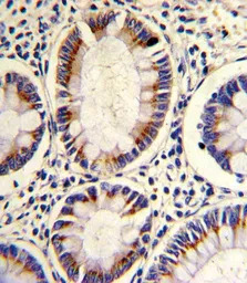 ARGBP2 antibody, N-term