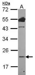 Lipocalin 1 antibody [N1C3]