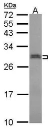 SNRPN antibody