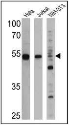 PPAR alpha antibody [3B6/PPAR]