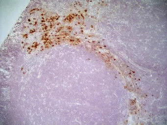 CD163 antibody [ED2]