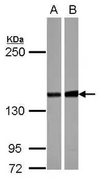 PPP2R3A antibody [C2C3], C-ter