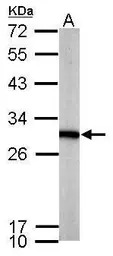 PGAM1 antibody [N1C3]