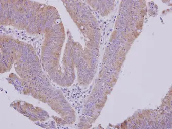 MTBP antibody [N1N3]