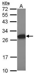 Tesmin antibody [N1C1]