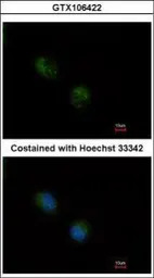 STMN2 antibody
